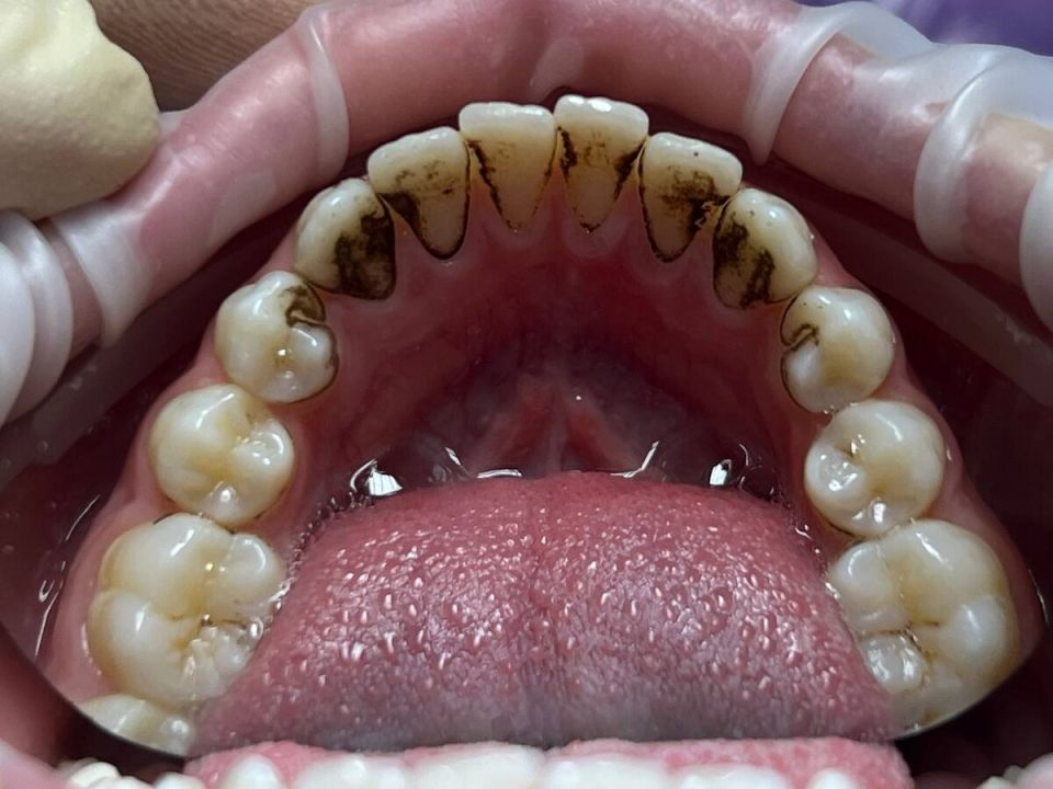     :   ?