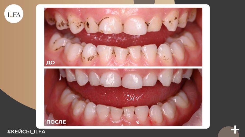 ���� �������: ��� ��� � ��� ��� ���������?