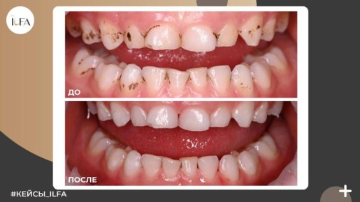 ���� �������: ��� ��� � ��� ��� ���������?